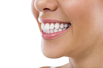Dr-Ebel-Bruehl-leistungen-Bleaching Bleaching, Zahnarztpraxis Ebel und Kollegen